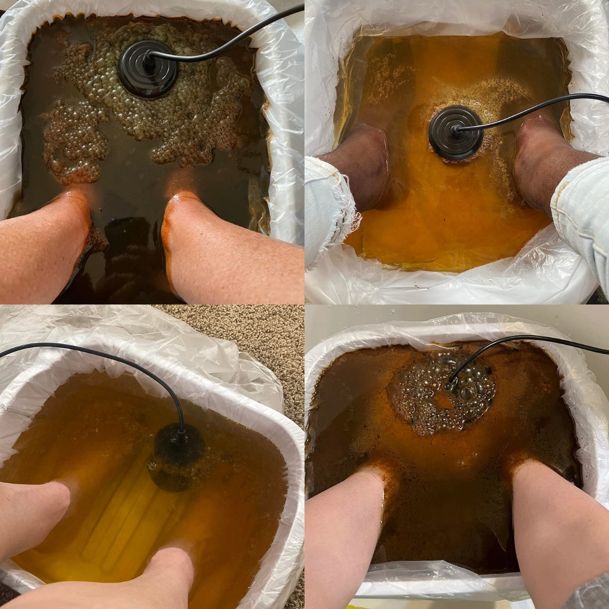 Aqualyte | Ionenelekrolyse-Fußbad für den Heimgebrauch