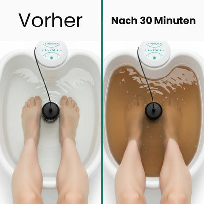 Aqualyte | Ionenelekrolyse-Fußbad für den Heimgebrauch